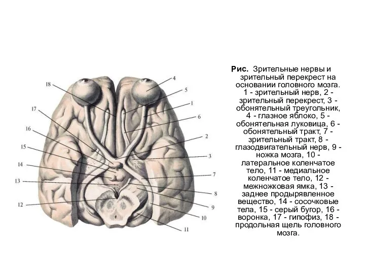 Рис. Зрительные нервы и зрительный перекрест на основании головного мозга. 1 -