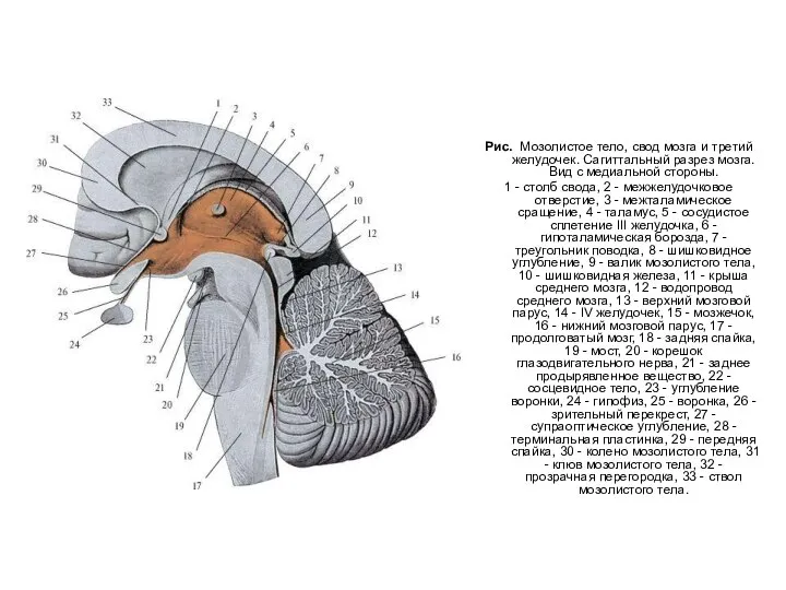 Рис. Мозолистое тело, свод мозга и третий желудочек. Сагиттальный разрез мозга. Вид