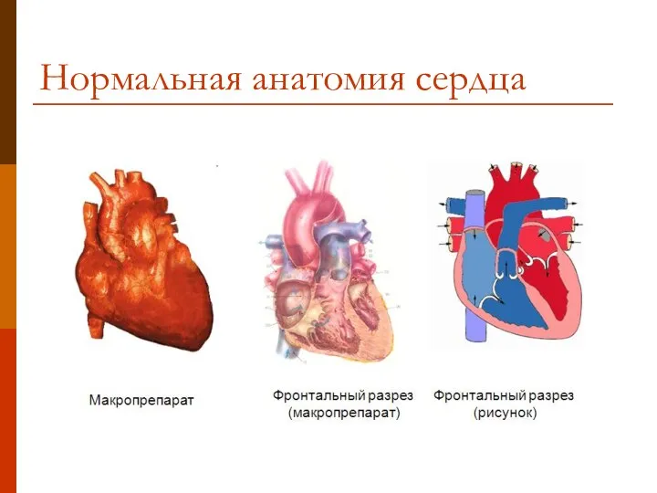 Нормальная анатомия сердца