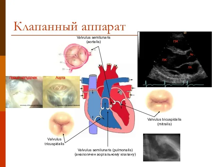 Клапанный аппарат Valvulus semilunaris (aortalis) Valvulus tricuspidalis Valvulus bicuspidalis (mitralis) Valvulus semilunaris (pulmonalis) (аналогичен аортальному клапану)