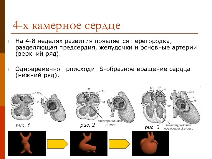 4-х камерное сердце На 4-8 неделях развития появляется перегородка, разделяющая предсердия, желудочки