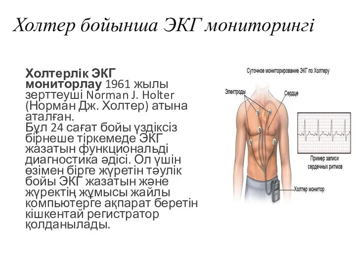 Холтер бойынша ЭКГ мониторингі Холтерлік ЭКГ мониторлау 1961 жылы зерттеуші Norman J.