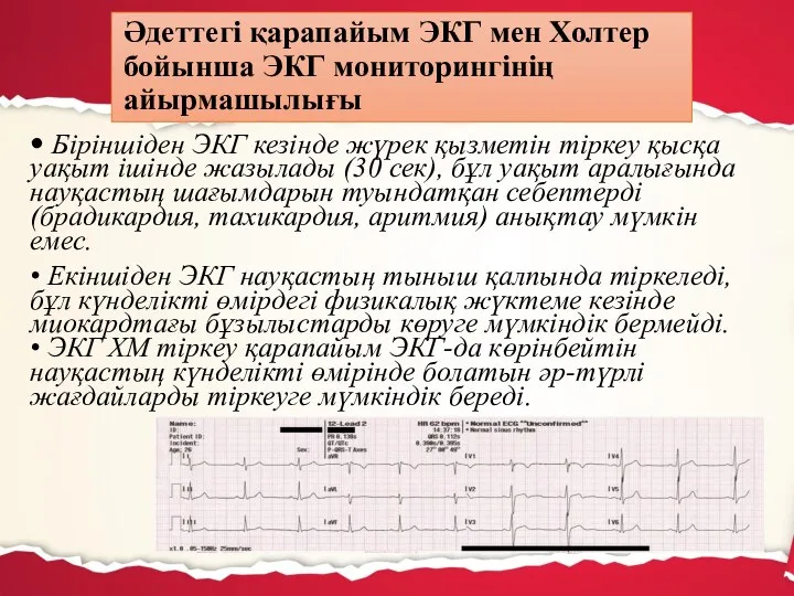 • Біріншіден ЭКГ кезінде жүрек қызметін тіркеу қысқа уақыт ішінде жазылады (30