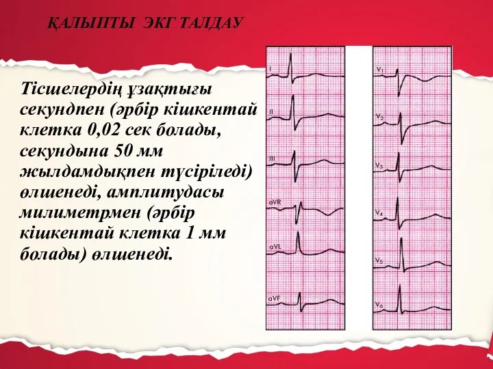 Тісшелердің ұзақтығы секундпен (әрбір кішкентай клетка 0,02 сек болады, секундына 50 мм