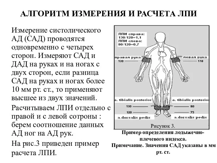 АЛГОРИТМ ИЗМЕРЕНИЯ И РАСЧЕТА ЛПИ Измерение систолического АД (САД) проводятся одновременно с