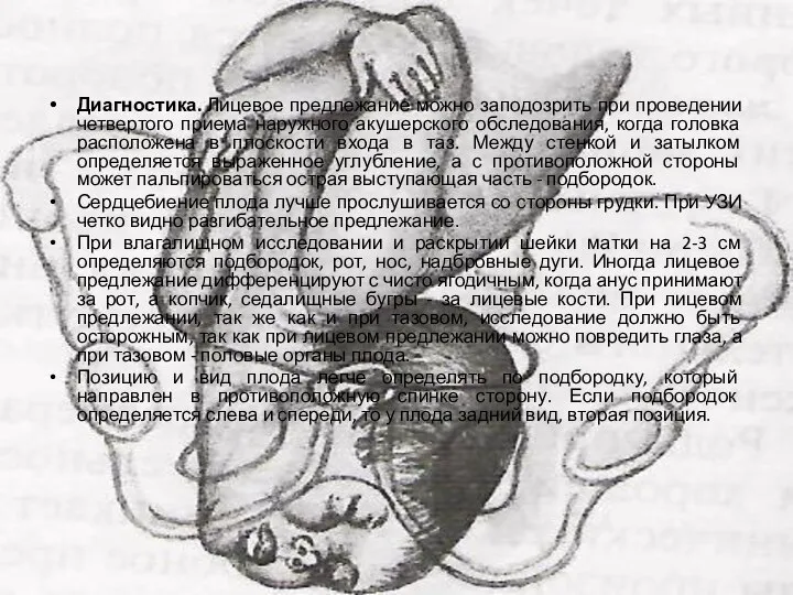 Диагностика. Лицевое предлежание можно заподозрить при проведении четвертого приема наружного акушерского обследования,