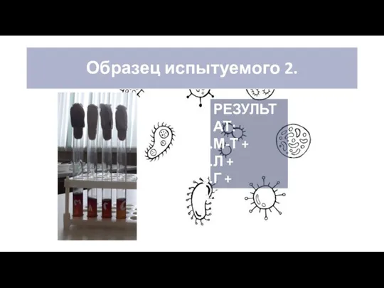 Образец испытуемого 2. РЕЗУЛЬТАТ: М-Т + Л + Г + С +