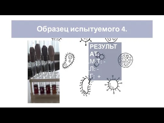 Образец испытуемого 4. РЕЗУЛЬТАТ: М-Т: - Л: - Г: + С: +