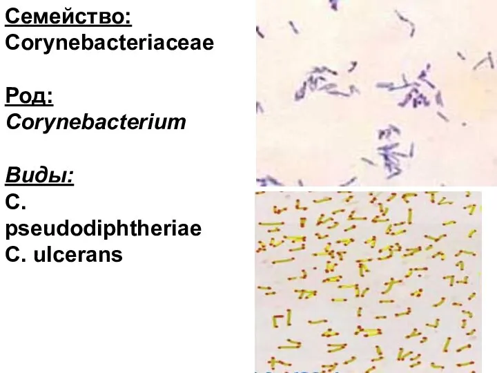 Семейство: Corynebacteriaceae Род: Corynebacterium Виды: С. рseudodiphtheriae С. ulcerans