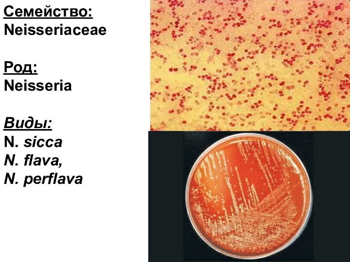 Семейство: Neisseriaceae Род: Neisseria Виды: N. sicca N. flava, N. perflava
