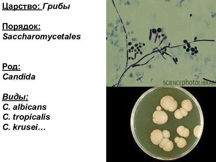 Царство: Грибы Порядок: Saccharomycetales Род: Candida Виды: C. albicans C. tropicalis C. krusei…