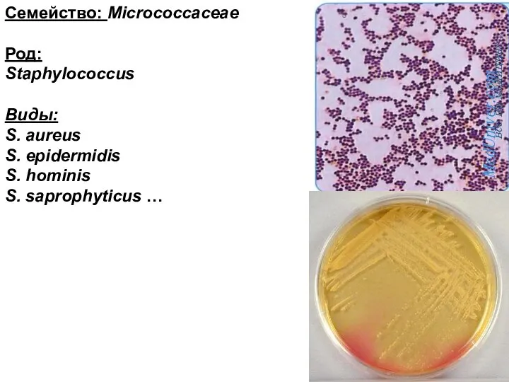 Семейство: Micrococcaceae Род: Staphylococcus Виды: S. aureus S. epidermidis S. hominis S. saprophyticus …