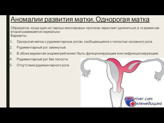 Аномалии развития матки. Однорогая матка Образуется, когда один из парных мюллеровых протоков