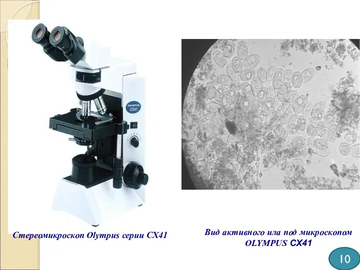 10 Стереомикроскоп Olympus серии CX41 Вид активного ила под микроскопом OLYMPUS CX41