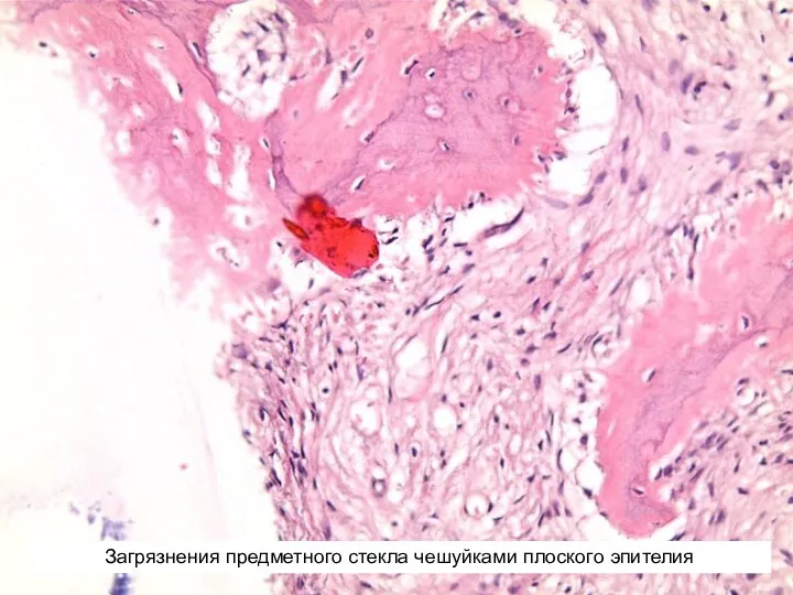 Загрязнения предметного стекла чешуйками плоского эпителия