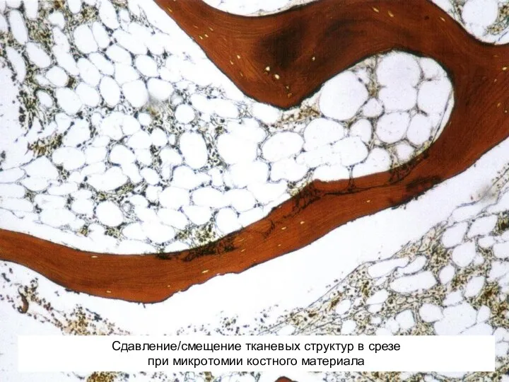 Сдавление/смещение тканевых структур в срезе при микротомии костного материала