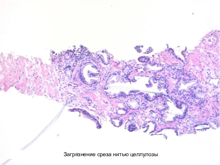 Загрязнение среза нитью целлулозы