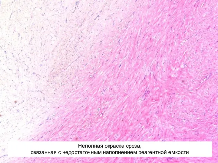 Неполная окраска среза, связанная с недостаточным наполнением реагентной емкости