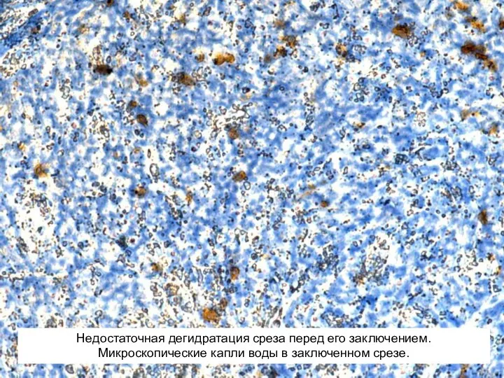 Недостаточная дегидратация среза перед его заключением. Микроскопические капли воды в заключенном срезе.