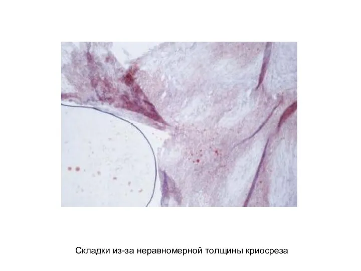 Складки из-за неравномерной толщины криосреза