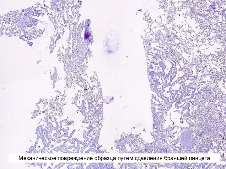 Механическое повреждение образца путем сдавления браншей пинцета