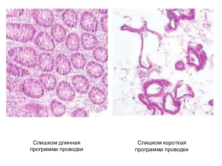 Слишком длинная программа проводки Слишком короткая программа проводки