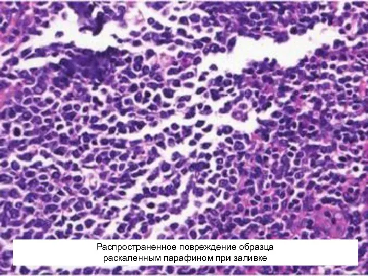 Распространенное повреждение образца раскаленным парафином при заливке