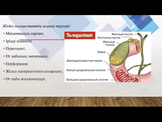 Жедел холециститтің асқыну түрлері: Механикалық сарғаю; Іріңді холангит Перитонит; Өт қабының эмпиемасы;