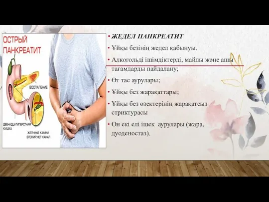 ЖЕДЕЛ ПАНКРЕАТИТ Ұйқы безінің жедел қабынуы. Алкогольді ішімдіктерді, майлы және ашы тағамдарды