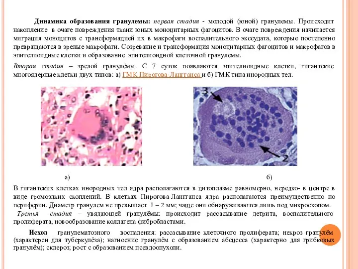 Динамика образования гранулемы: первая стадия - молодой (юной) гранулемы. Происходит накопление в