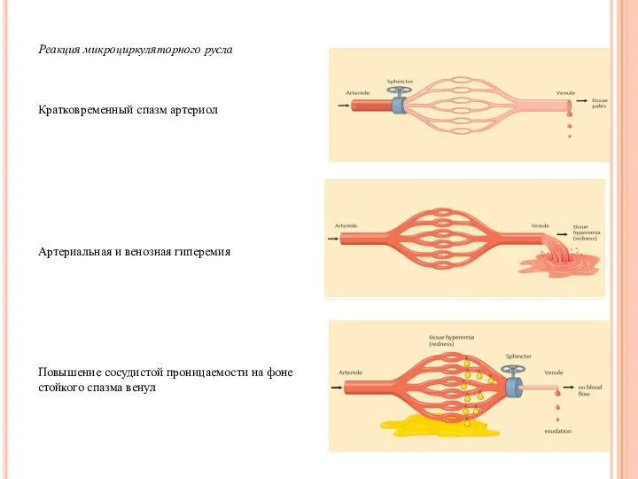 Реакция микроциркуляторного русла Кратковременный спазм артериол Артериальная и венозная гиперемия Повышение сосудистой