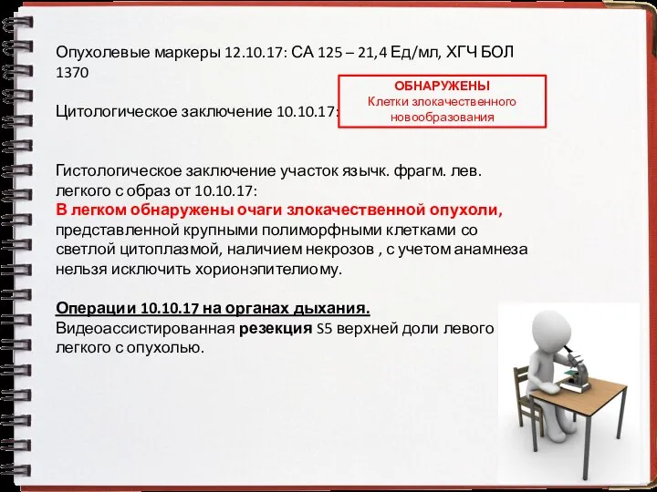 Опухолевые маркеры 12.10.17: СА 125 – 21,4 Ед/мл, ХГЧ БОЛ 1370 Цитологическое