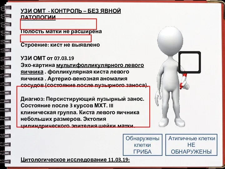 УЗИ ОМТ - КОНТРОЛЬ – БЕЗ ЯВНОЙ ПАТОЛОГИИ Полость матки не расширена