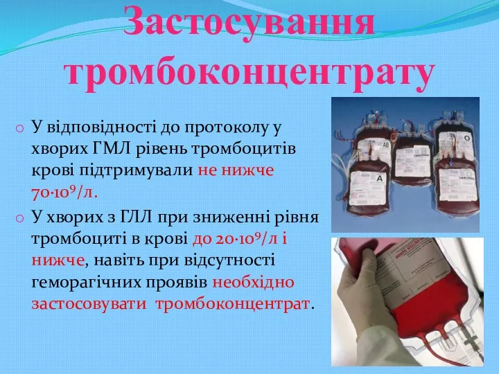 Застосування тромбоконцентрату У відповідності до протоколу у хворих ГМЛ рівень тромбоцитів крові