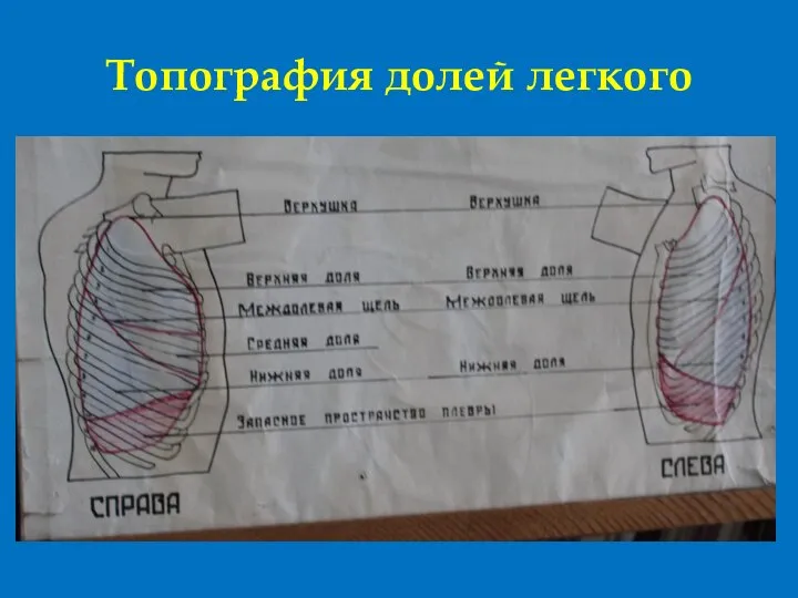 Топография долей легкого