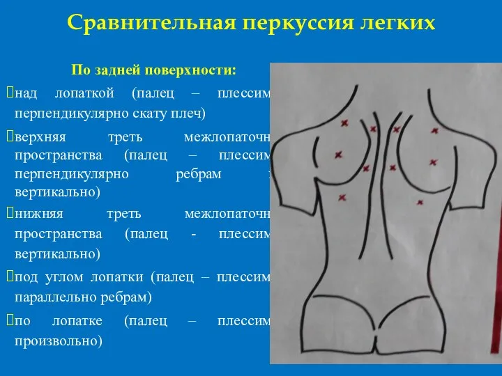 Сравнительная перкуссия легких По задней поверхности: над лопаткой (палец – плессиметр перпендикулярно