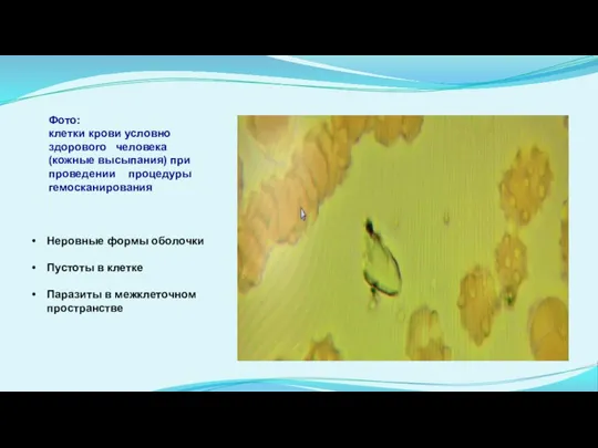 Неровные формы оболочки Пустоты в клетке Паразиты в межклеточном пространстве Фото: клетки