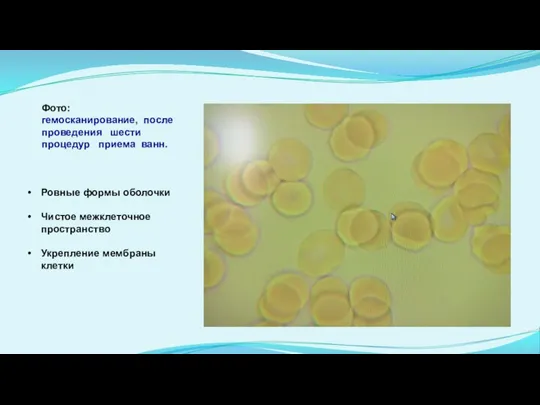 Ровные формы оболочки Чистое межклеточное пространство Укрепление мембраны клетки Фото: гемосканирование, после
