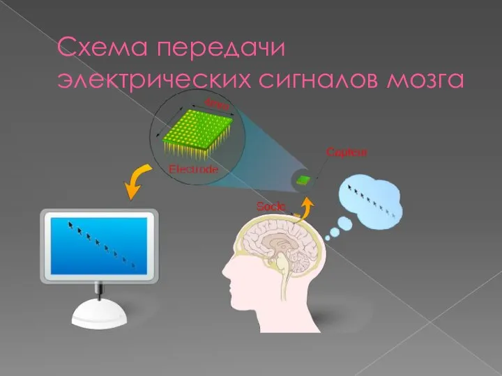 Схема передачи электрических сигналов мозга