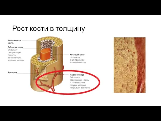 Рост кости в толщину