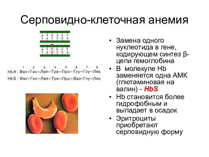 Серповидно-клеточная анемия Замена одного нуклеотида в гене, кодирующем синтез β-цепи гемоглобина В