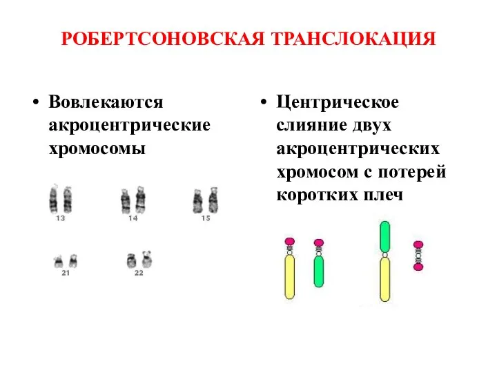 РОБЕРТСОНОВСКАЯ ТРАНСЛОКАЦИЯ Вовлекаются акроцентрические хромосомы Центрическое слияние двух акроцентрических хромосом с потерей коротких плеч