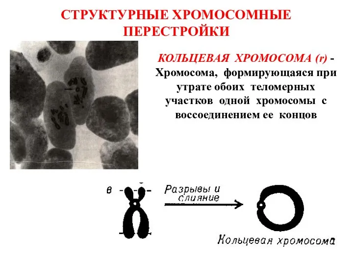 СТРУКТУРНЫЕ ХРОМОСОМНЫЕ ПЕРЕСТРОЙКИ КОЛЬЦЕВАЯ ХРОМОСОМА (r) - Хромосома, формирующаяся при утрате обоих