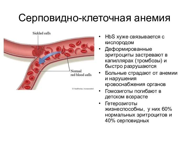 Серповидно-клеточная анемия НbS хуже связывается с кислородом Деформированные эритроциты застревают в капиллярах