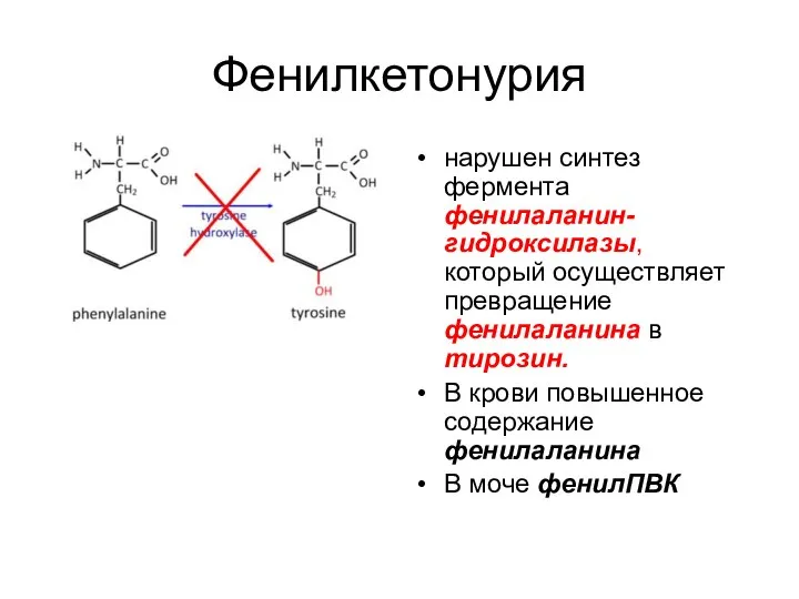 Фенилкетонурия нарушен синтез фермента фенилаланин-гидроксилазы, который осуществляет превращение фенилаланина в тирозин. В