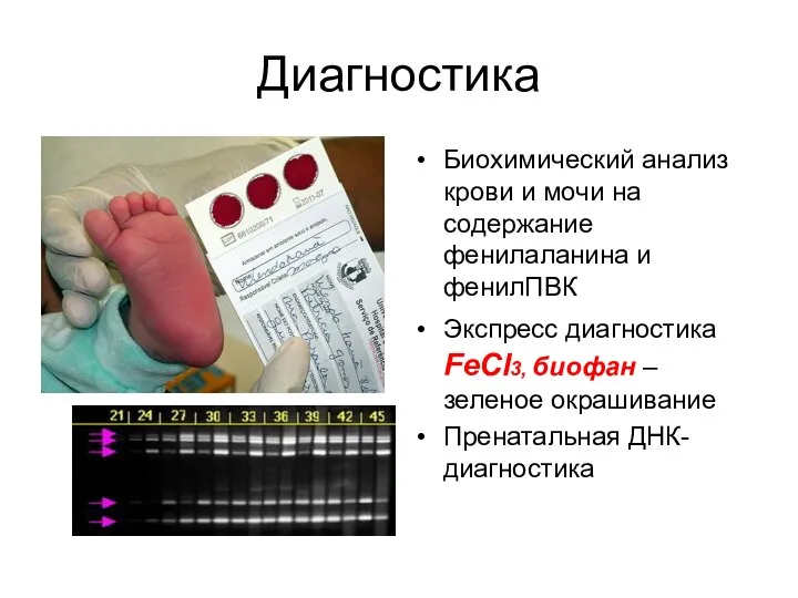 Диагностика Биохимический анализ крови и мочи на содержание фенилаланина и фенилПВК Экспресс