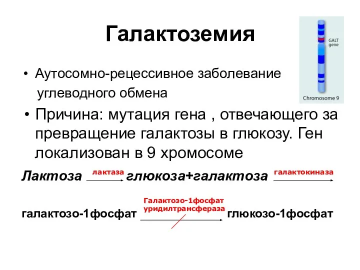 Галактоземия Аутосомно-рецессивное заболевание углеводного обмена Причина: мутация гена , отвечающего за превращение