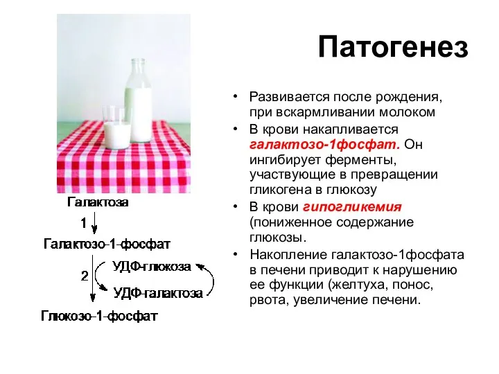 Патогенез Развивается после рождения, при вскармливании молоком В крови накапливается галактозо-1фосфат. Он