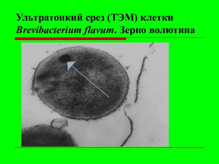 Ультратонкий срез (ТЭМ) клетки Brevibacterium flavum. Зерно волютина