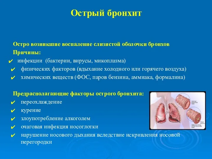 Острый бронхит Остро возникшие воспаление слизистой оболочки бронхов Причины: инфекции (бактерии, вирусы,